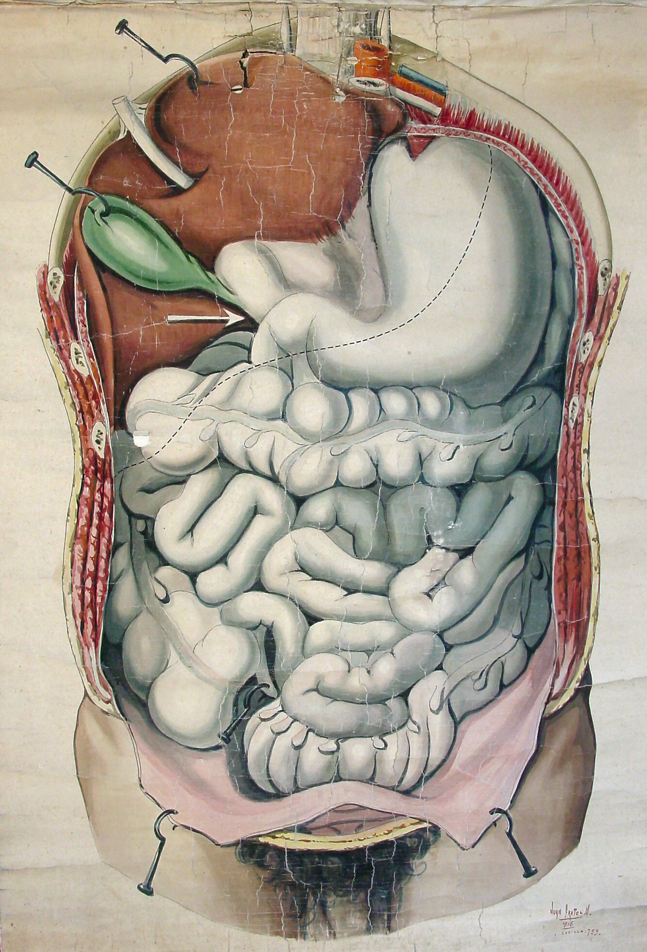 I14
