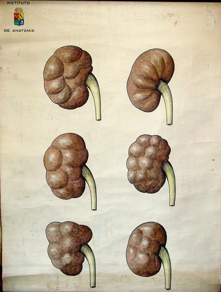 J1